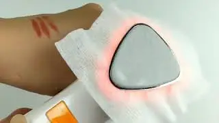 #Dermalshop #Hot Cold Hammer #Cryotherapy Face Lifting Electric anti aging Skin Tightening Device