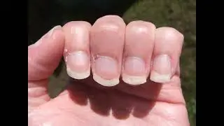41 : nail biting spit and hands fetish journey in 2021/ Evolution de mes mains et ongles en 2021(5)