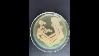 How to get isolated bacterial colony in last quadrant? - Introducing 6-3 cascade streaking!