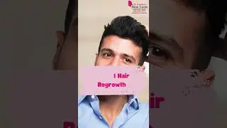 Say goodbye to baldness and hello to confidence! #BaldnessSolution #HairRegrowth #PainFreeProcedure