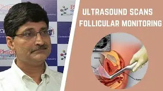 Everything about follicular tracking ultrasound scan | Ovulation tracking