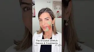 #jowls #jowltreatment #botoxtraining #fillertraining #drbitafarrell