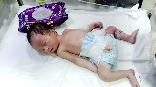 Birth Asphyxia Babys First Step Recovery Early Physiotherapy Started in NICU Hopeful Healing Journey