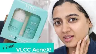 How to Get Glowing Acne Free Skin this Festive Season | VLCC AcneX 2-step combo