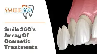 Smile 360's Array Of Cosmetic Treatments