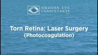 Torn Retina Photocoagulation Procedure