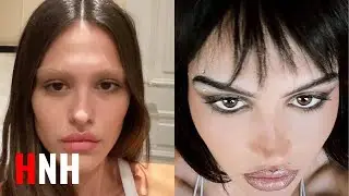Amelia Gray Hamlin Opens Up About Plastic Surgery Procedures She's Had Done
