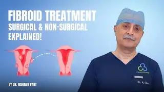 Best Treatment for Fibroids Surgical vs Non Surgical Full Guide by Specialist