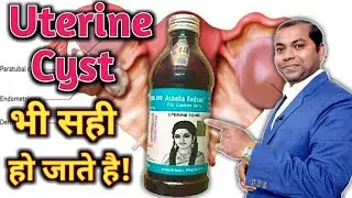 Ashoka Radson Syrup Uses And Side Effects | Ashoka Radson | Ashoka Radson In Hindi | Uterine Tonic |