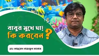 বাবুর মুখে ঘা! কি করবেন || ডাঃ আহমেদ নাজমুল আনাম || FCPS, MD- Assistant Professor, ICMH