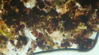 Microscope accident