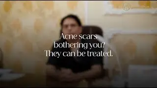 Acne Scars Treatment Explained | Acne Scars Ka Best Treatment Kya Hai?