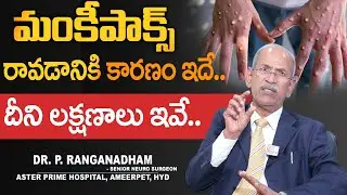 MonkeyPox Symptoms | Monkeypox Virus Outbreak in India | WHO Issues High Alert | Monkey Pox Virus