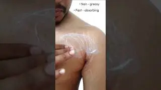 I Tried This HERBAL CREAM for Stretch Marks and Got AMAZING Results 😱😲