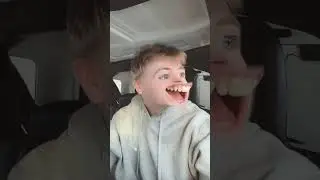 When You Look Outside The Car Window As A Kid #Shorts