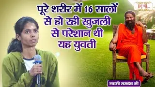 पूरे शरीर में 16 सालों से हो रही खुजली से परेशान थी यह युवती | Swami Ramdev Ji | Yoga & Ayurveda