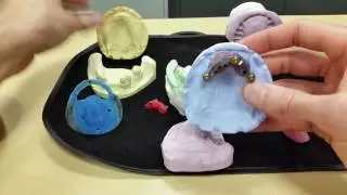🎉Ultimate guide for Bar Over Denture🎉 Dr.  Derek B.  Gatta