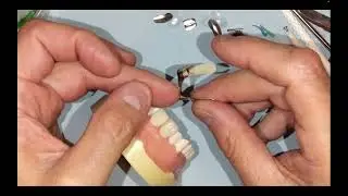 Dental Webinar: Composite Resin Matrix Clip with Dr. Bob Margeas and Dr. Marcos Vargas