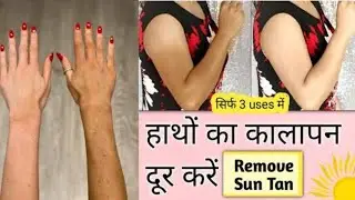 Instant Sun Tan Removal pack //Fair Hand, Feet & Nack  #skincare #viralvideo #skincaretips