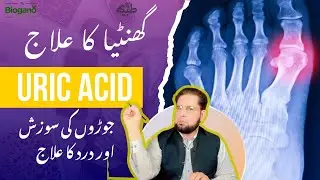High and Low Uric Acid Levels | Gout - Bone, Joint, and Muscle Disorders