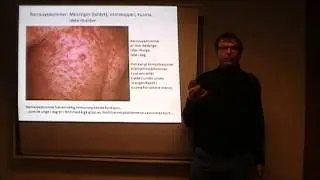 Vaksiner Ingredienser, virkninger og overtro (del 12 av 17)
