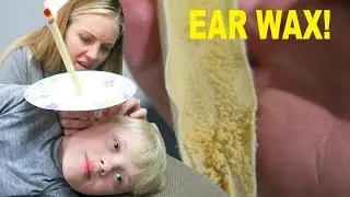 TONS OF NASTY EAR WAX REMOVED! WILL IT ALL COME OUT?