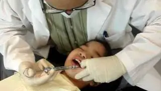 Root Canal of a 4-year old
