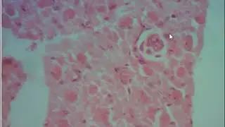 Huso neuromuscular