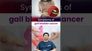 Early Symptoms of Gallbladder Cancer You Shouldn&rsquo;t Ignore | Dr Ajesh