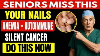 Doctor Warns THESE Nail Signs Reveal Hidden Disease After 60 | Senior Vitality