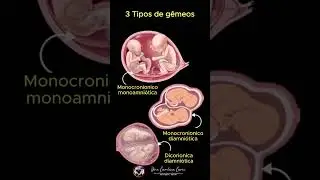 👶👶 Quais os 3 Tipos de G&ecirc;meos