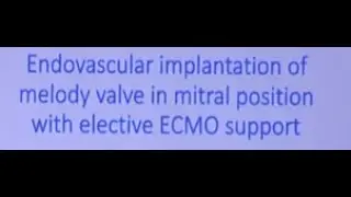 Endovascular implantation of melody valve in mitral position with elective ECMO support