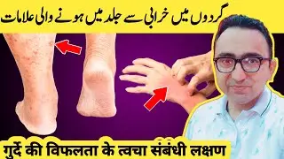 7 Skin Signs Of Kidney Disease You Should Not Ignore