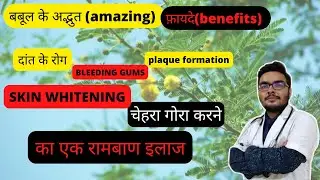 बबूल (BABOOL) अद्भुत फ़ायदे | AMAZING BENEFITS | BEST MEDICINE FOR SKIN AND TEETH | EXPERT WELLBEING