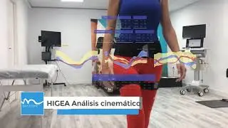 An&aacute;lisis Biomec&aacute;nico en motion&balance con Inteligencia Artificial
