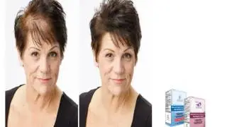 hair loss guinea pigs