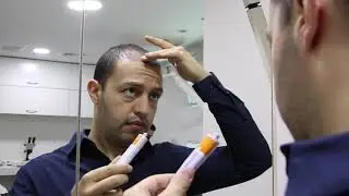 NOVAPEL CUIDADOS POST-PROCEDIMIENTO DE UN TRASPLANTE DE CABELLO