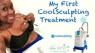 My First CoolSculpting Treatment
