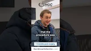 Real Results | Hair Transplant Testimonial at Hair Growth Centre UK