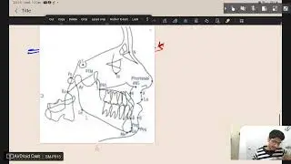 CEPHALOMETRY IN EASIEST WAY LANDMARKS PLUS DOWN ANALYSIS 1