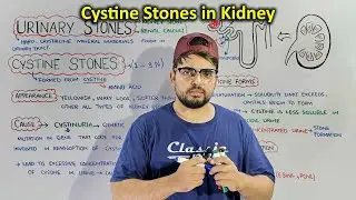 Cystine Stones: A Type of Kidney stones (Cistinuria)
