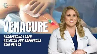 VenaCure: Endovenous Laser Ablation for Saphenous Vein Reflux | Quick & Effective Treatment