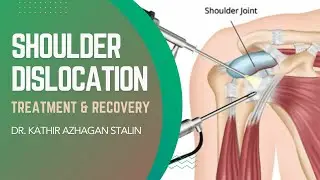 Shoulder Dislocation Solutions: Expert Advice from Dr. Kathir Azhagan Stalin | MMM Hospital Vellore