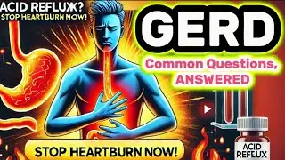 ACID REFLUX? How to Stop Heartburn Fast! Best GERD Treatment & Prevention Tips