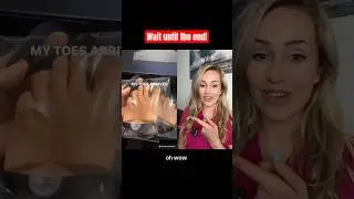 Doctor reacts: missing toes
