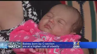 HealthWatch: C-Section Obesity Risk, Baby Talk Same Around World