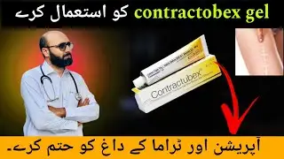 Contractubex Gel | Advanced Scar Treatment and Management | side effects of contractubex gel|