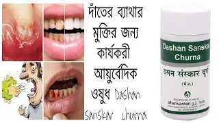 Dasan Sanshkar Churna Ayurvedic medicine for teeth,gum problems দাঁত,মাড়ির ব্যাথার আয়ুর্বেদিক ওষুধ