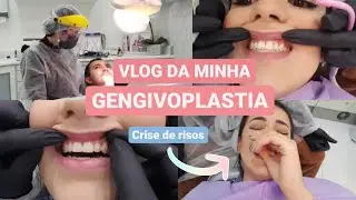 MEU PROCEDIMENTO DE GENGIVOPLASTIA | ANESTESIA E MUITA RISADA | Alexia Nogueira  #vlog