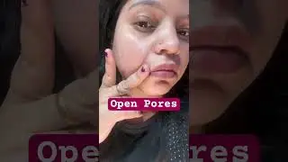Aj ka Natural Hack for Open Pores 💧✨